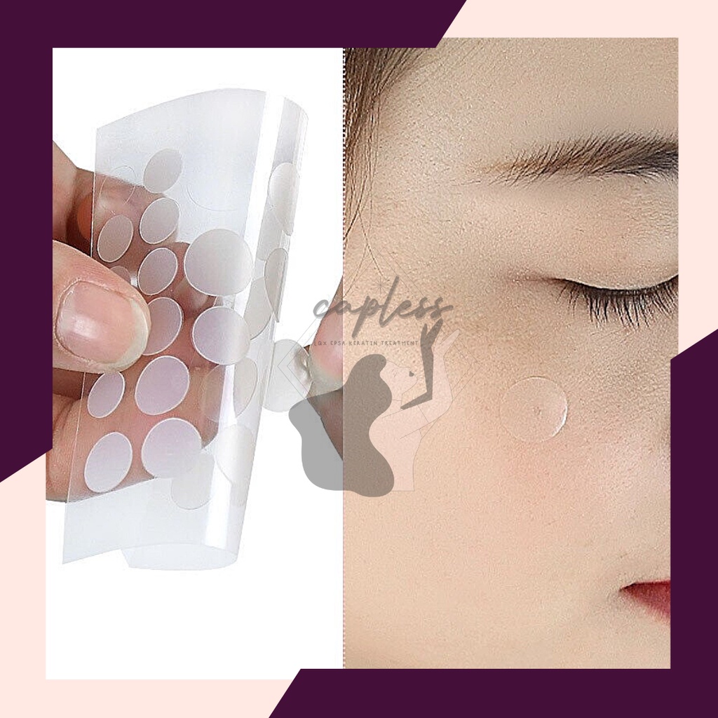 Pcs Invisible Acne Pimple Removal Patch Acne Hydrocolloid Stickers