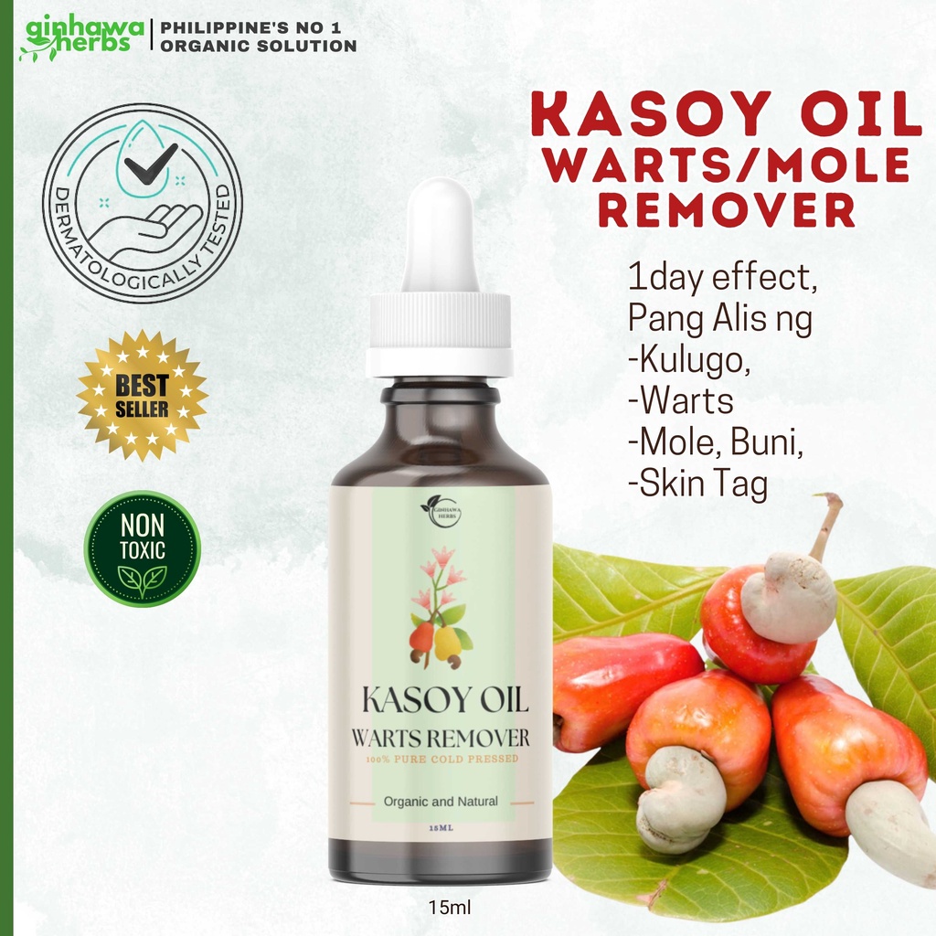 Kasoy Oil Warts Remover With Salicylic Acid And Aloe Vera Infusion