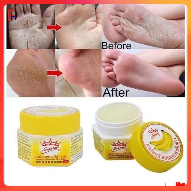 Thailand Supreme Banana Moisturizing Heel Blam Pc Shopee Philippines