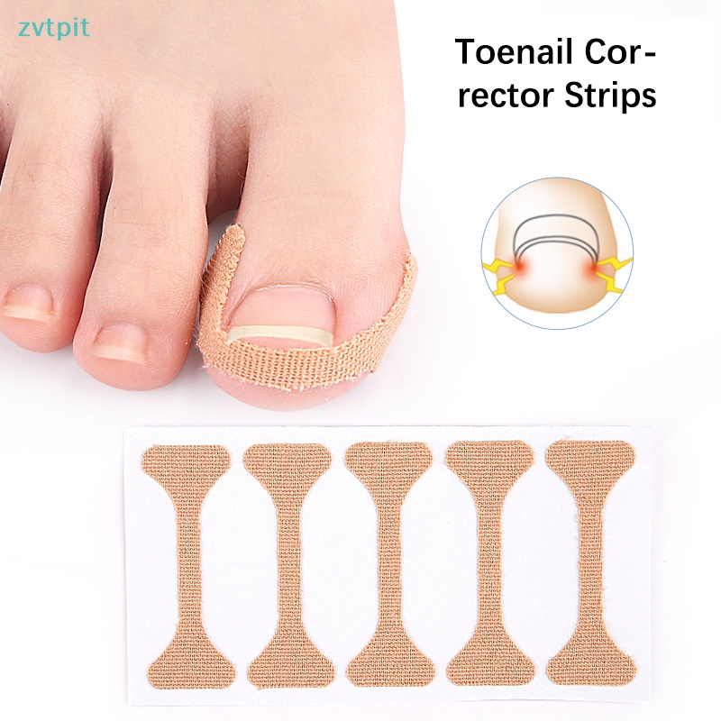 ZVT 5 15 30 Pcs Ingrown Paronychia Toenail Corrector Strips Anti