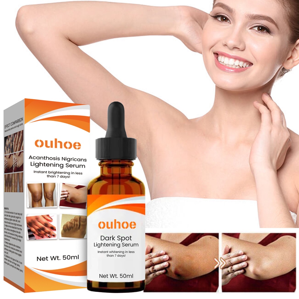 OUHOE Dark Spot Lightening Serum Whitening Body Serum Lightening