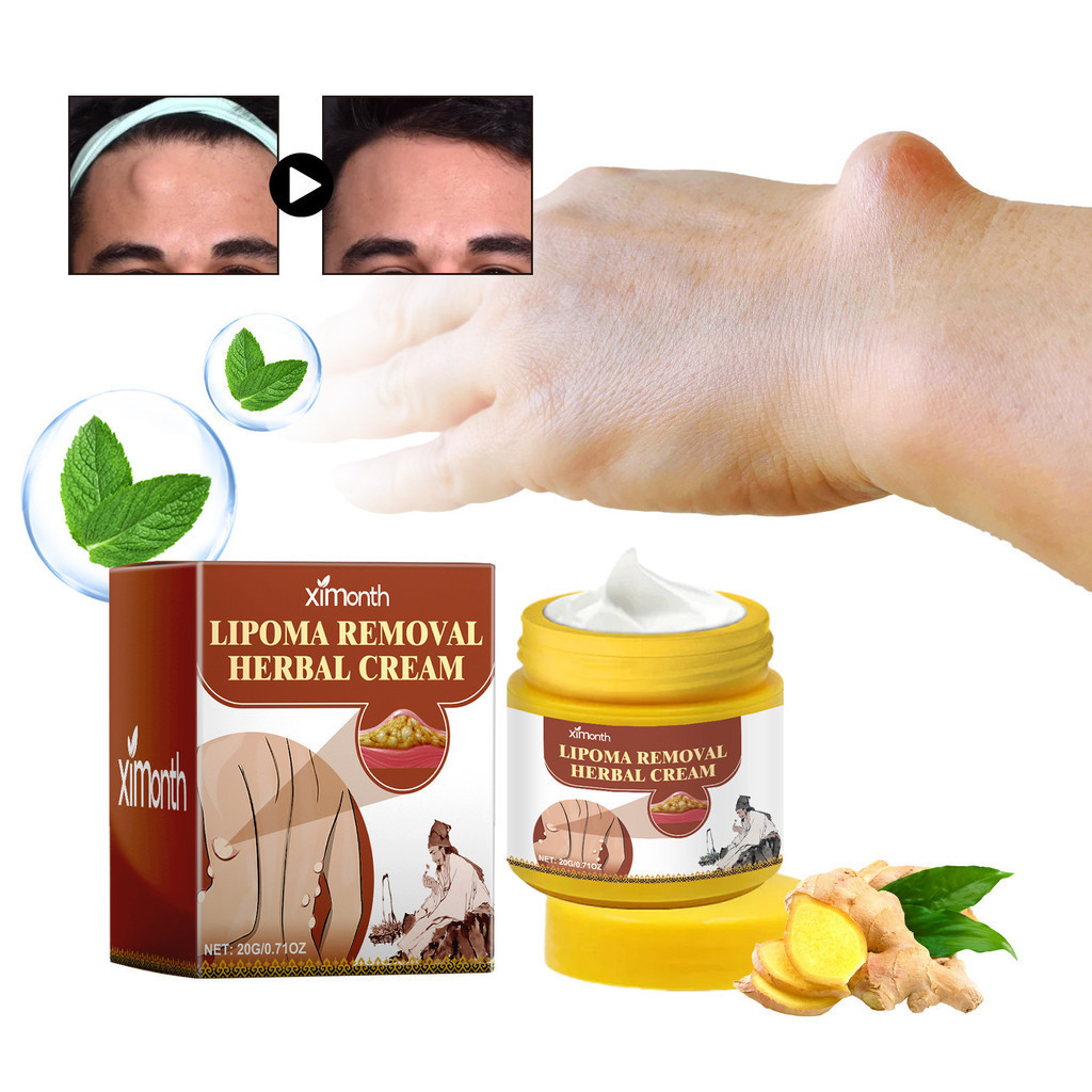 Lipoma Removal Cream Lumpfree Lipoma Removal Cream Natural Herbal