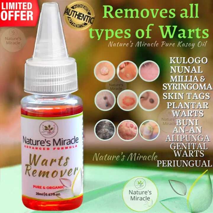 Warts Remover Skin Tags Remover Mole Remover Nunal Remover Kulugo