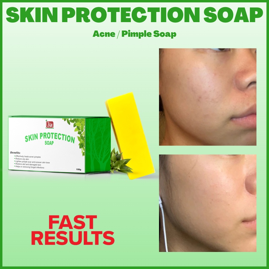 SKIN PROTECTION SOAP Affordable Acne / Pimple Soap (acne / pimple