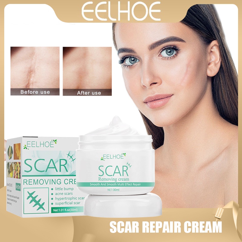 Eelhoe Scar Repair Cream Remove Salt Burns Scars Treat Body Old Gel Postoperative Anti Itch Skin 4248