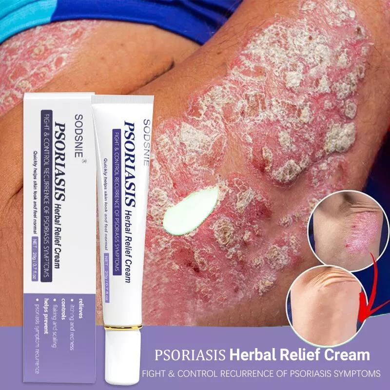 Herbal Psoriasis Treatment Cream Effective Antibacterial Anti Itch