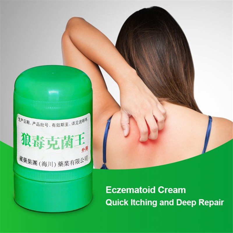 Chinese Herbal Antibacterial Ointment Soriasis Eczma Cream Fungal
