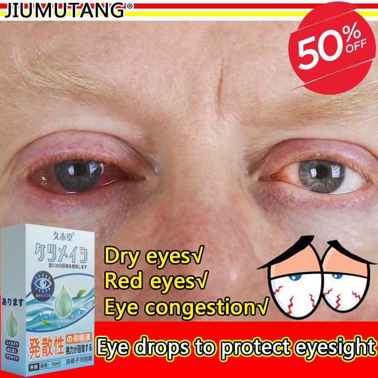JIUMUTANG Eye drops Eye Drops Japan Eye Drops Eye Care Eye Drops