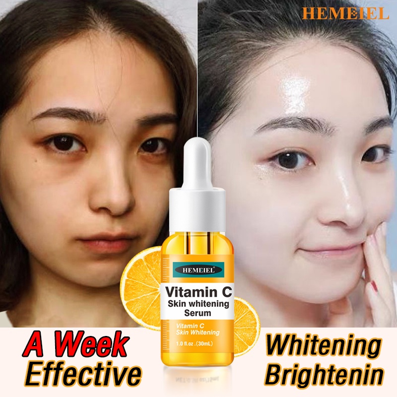 HEMEIEL Whitening Serum For Face/Dark Spot Remover/Hyaluronic Ac00