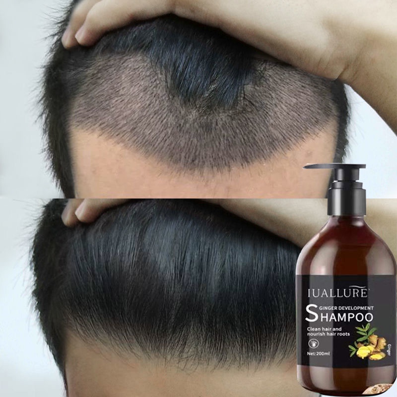 Ginger Shampoo Scalp Treatment AntiHair Loss shampoo japanese Shampoo Promotes Hair Growth