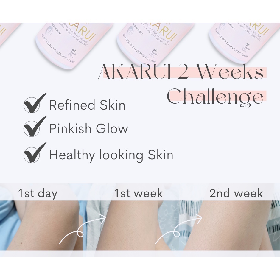 AKARUI JAPAN EFFECTIVE WHITENING GLUTATHIONE with COLLAGEN ,VITAMIN C  ,ALPHA LIPOIC ACID | Shopee Philippines