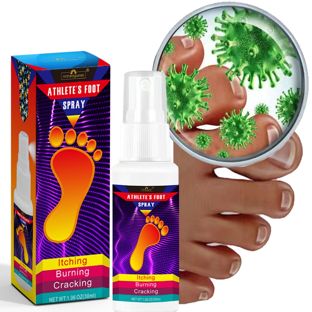 Instant Athlete's Foot Spray Herbal Anti Fungal Relieve Beriberi Cream
