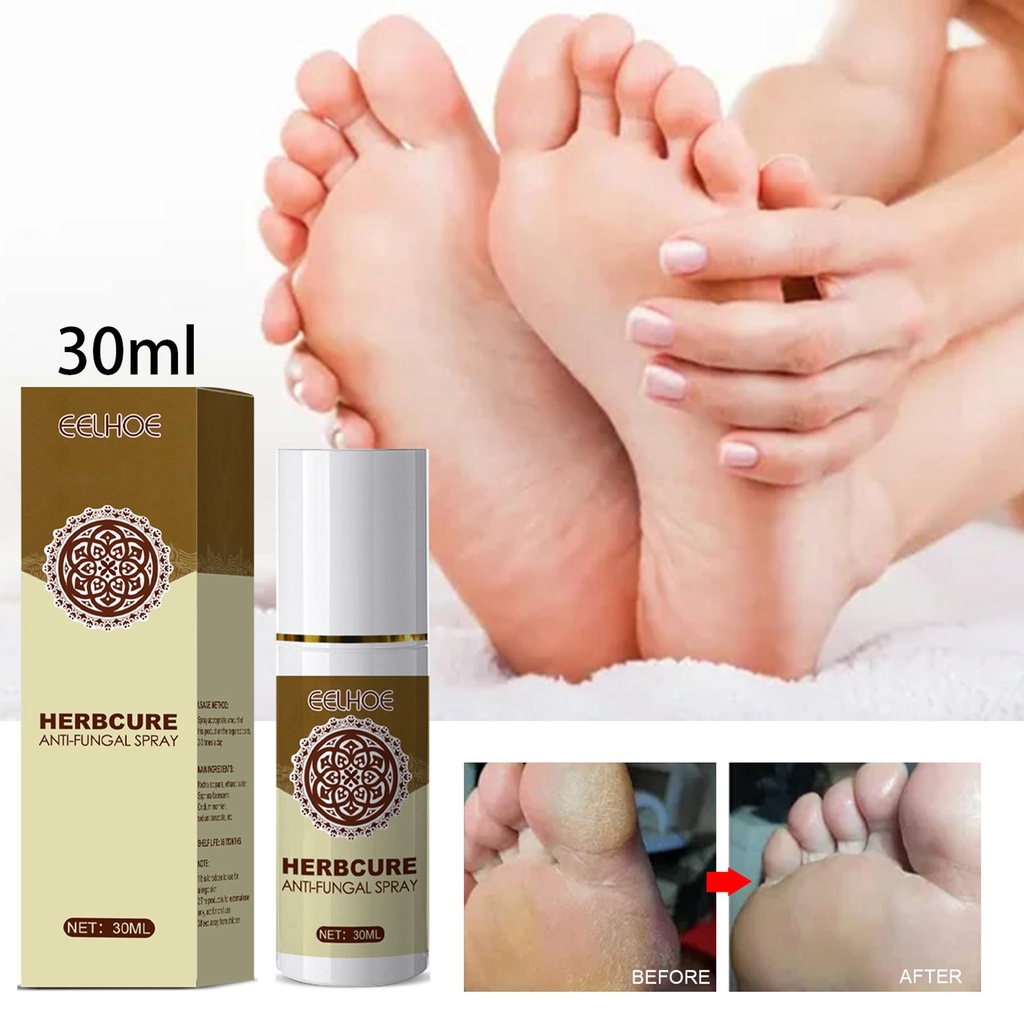 30ml Foot Odor Spray Fungal Combat Feet Spray Foot Sterilize Spray