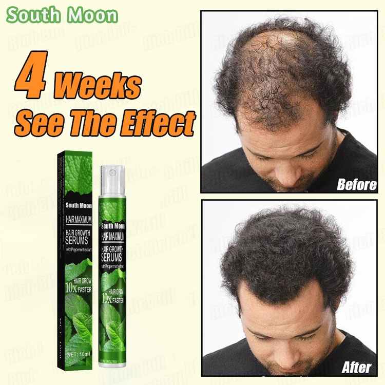 【2024】 hair growth spray Fast Powerful Pure Natural hair grower for men ...