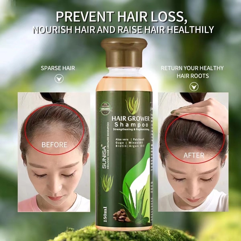 Extreme Hair Grower Shampoo 150ml sunisa | Shopee Philippines