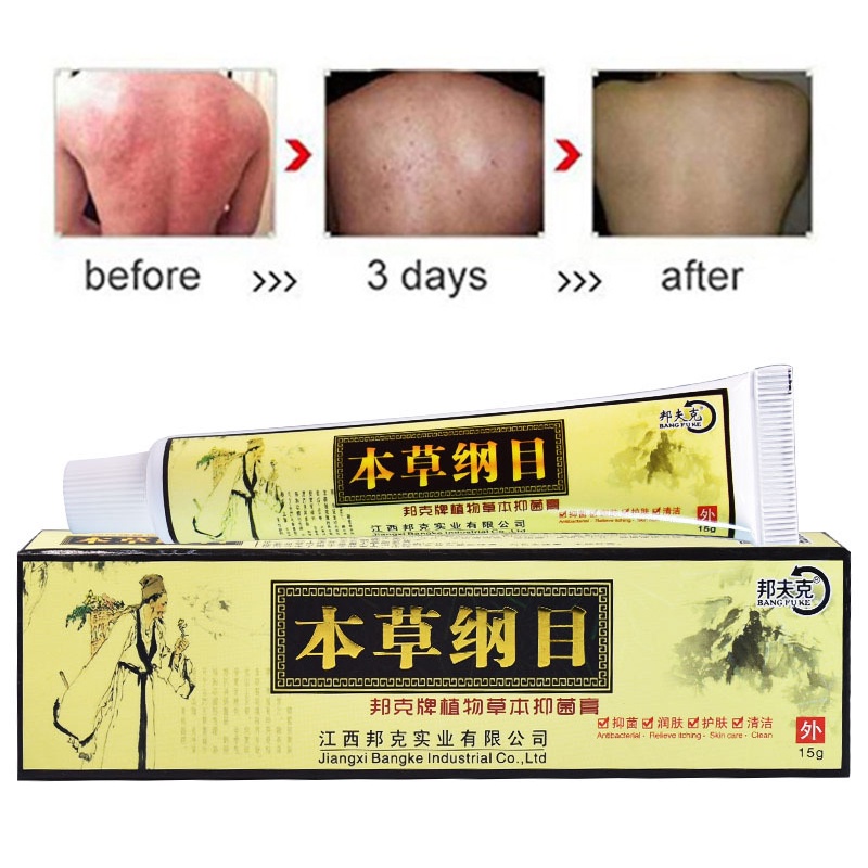 Chinese Herbal Eczema Psoriasis Cream Dermatitis And Eczema Pruritus ...