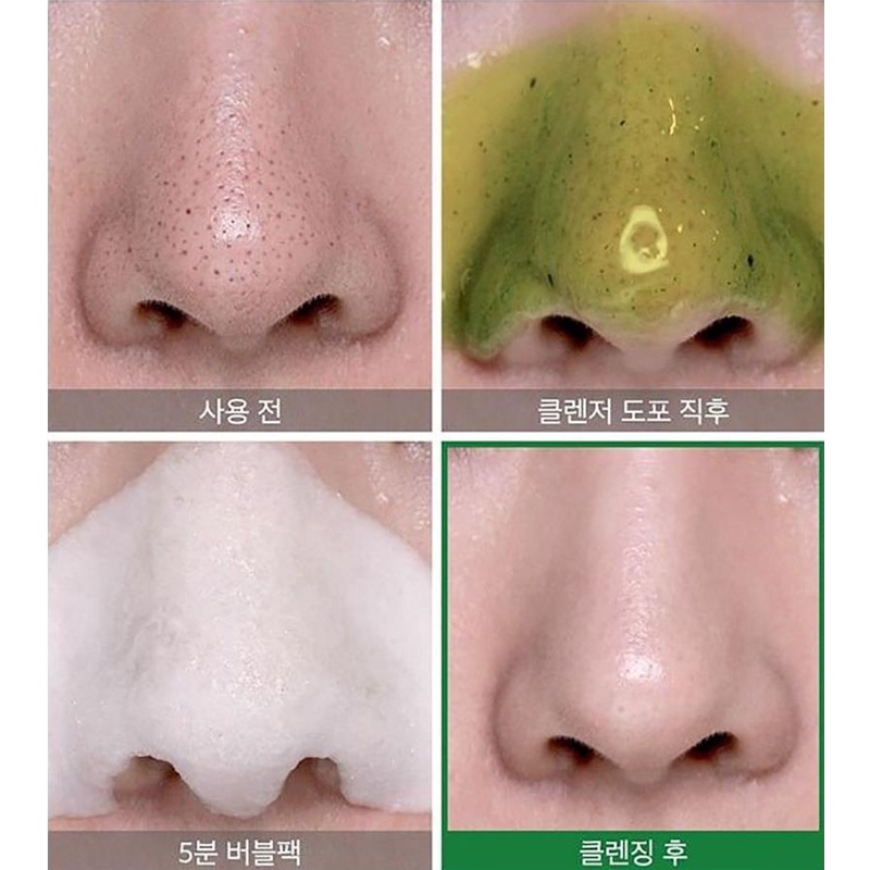 Some By Mi Bye Bye Blackhead 30 Days Miracle Green Tea Tox Bubble