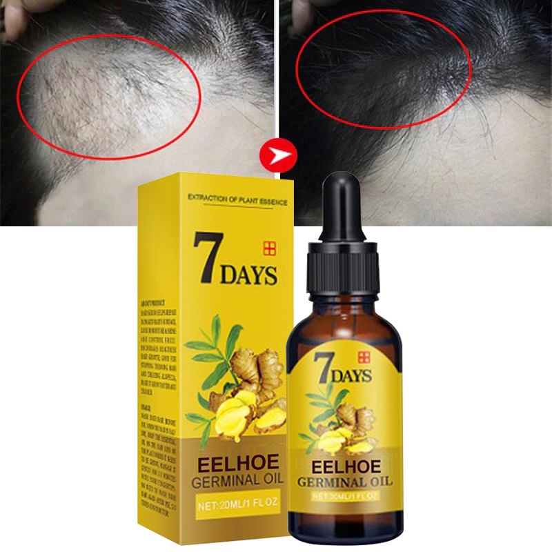 2022 NEW Ginger Hair Growth Serum Fast Growing Hair Essential Oil