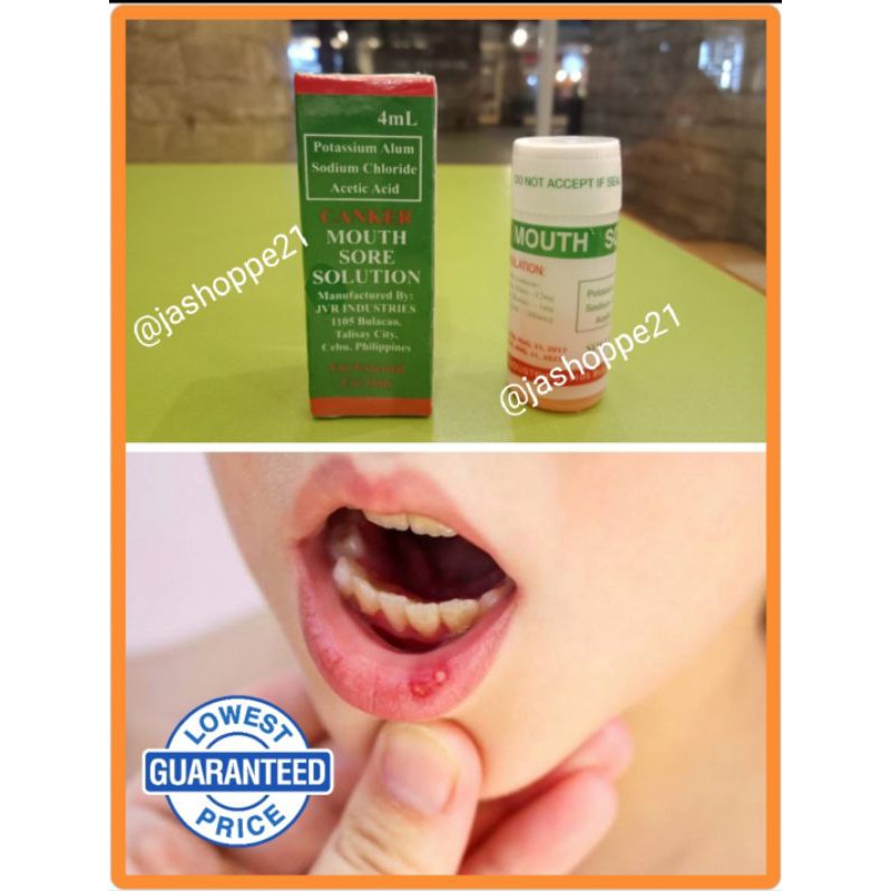 THE ORIGINAL AND EFFECTIVE CANKER MOUTH SORE SOLUTION GAMOT SA SINGAW