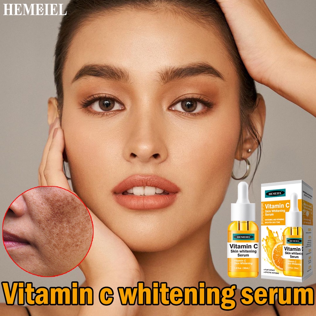 HEMEIEL Vitamin C Serum/Niacinamide/Melasma Cream Pekas Remover