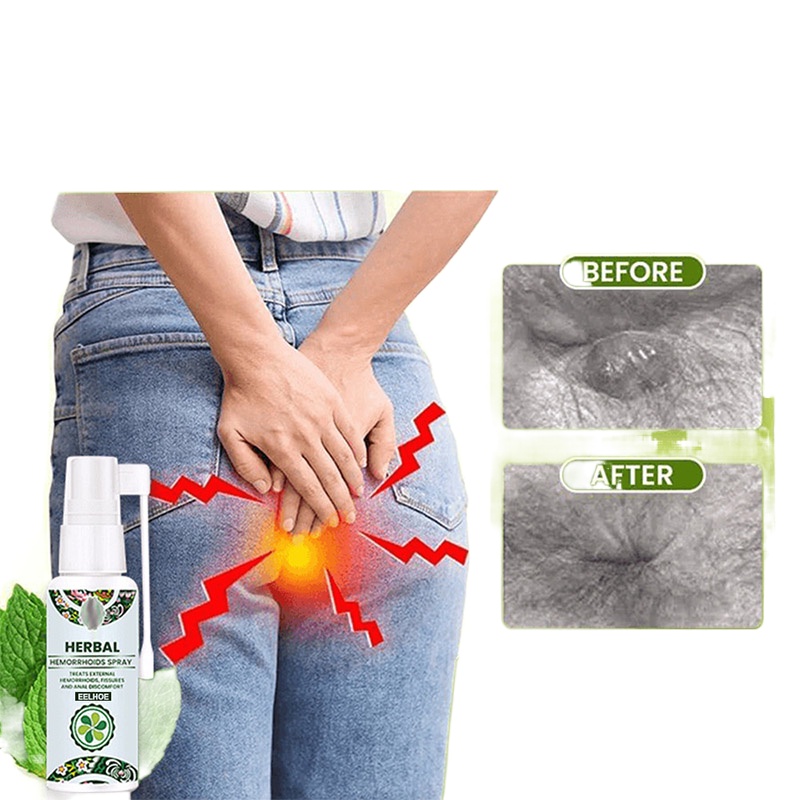 Original Herbal Hemorrhoids Spray Natural Safe And Effective Treatment Of Hemorrhoids Chinese 0545