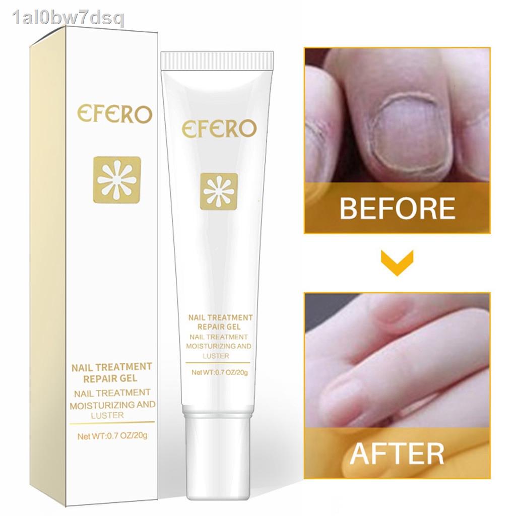 EFERO Fungal Nail Treatment Essence Nail And Foot Fungus Removal Feet