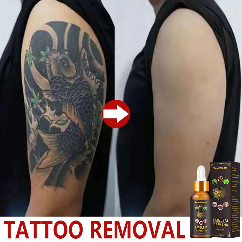 Tattoo Tattoo Removal Tattoo Removal Cream Permanent Eyebrow Remover Tattoo Eraser Permanent
