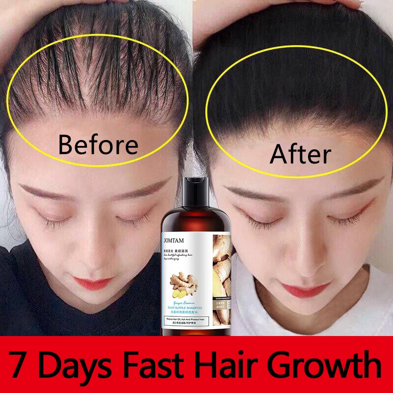 Ginger shampoo, antihair loss, repair dry hair, antidandruff