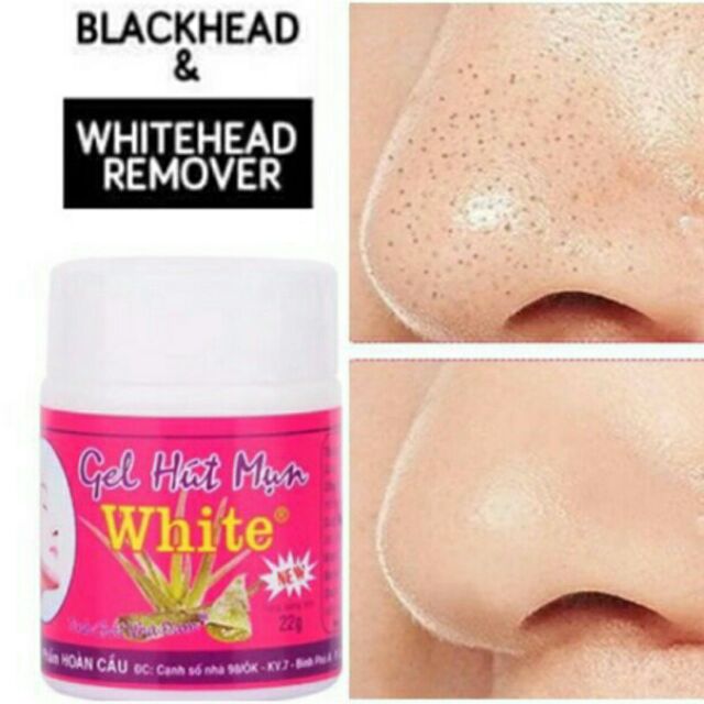 Blackheads & Whiteheads Remover Shopee Philippines