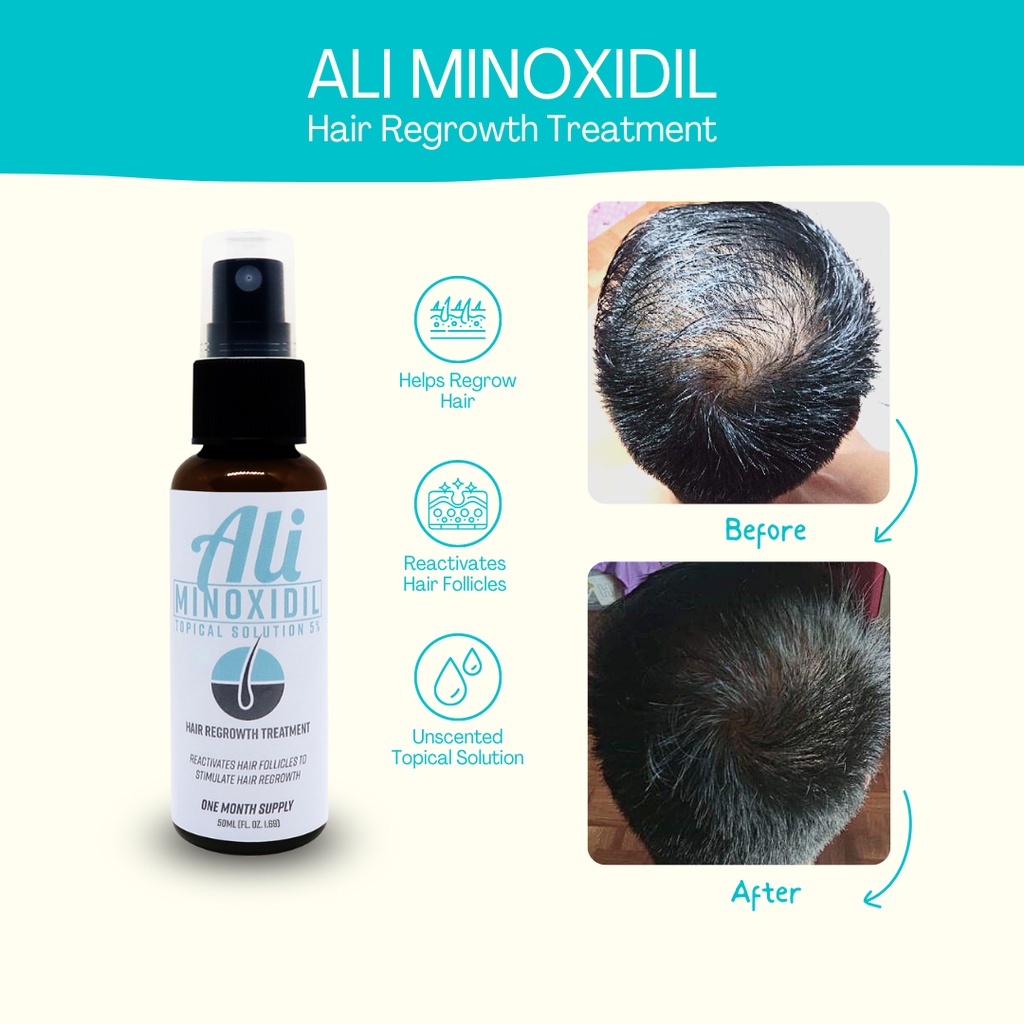 Ali Original Hair Grower Anti Hair Loss Treatment Regrowth Serum Hair ...