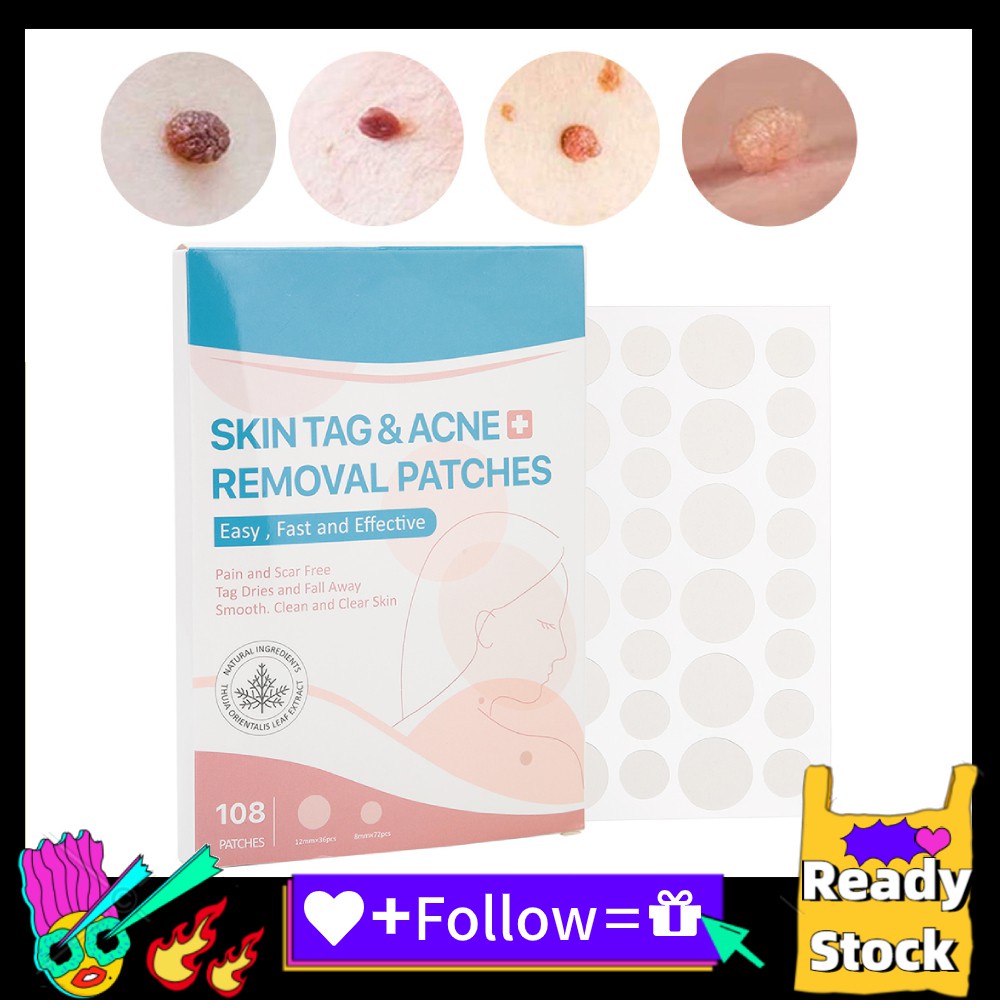 【SUPER MEGA-SALE 】 Icegg 108pcs / box Skin Tag Removal Patch Wart ...