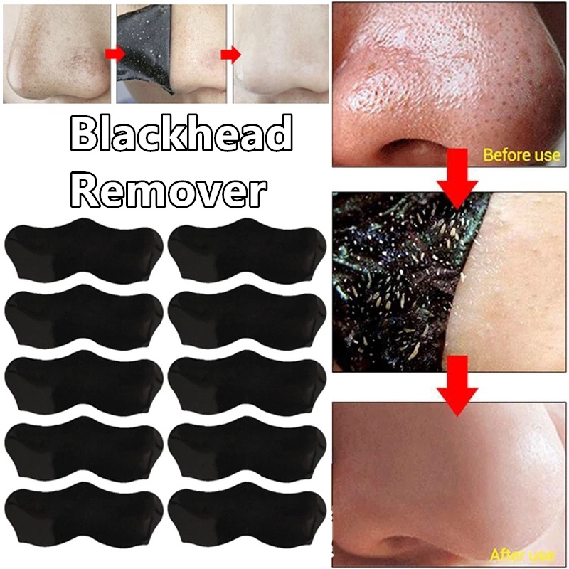 Blackhead Remove Mask Peel Nasal Strips Deep Cleansing Shrink Pore Nose Black Head Remove 6378