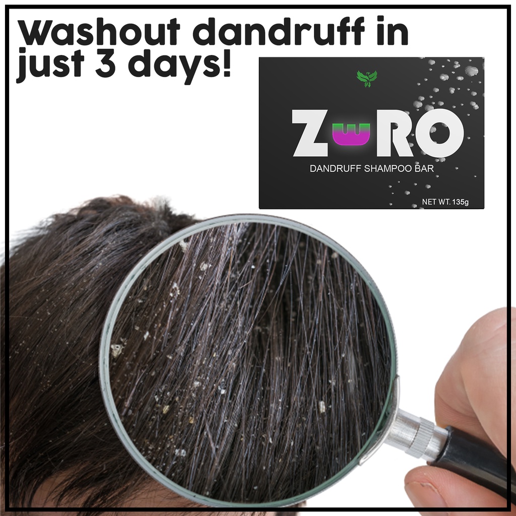 ZERO Removes Dandruff in just 3 days (For heavy dandruff, Anti dandruff