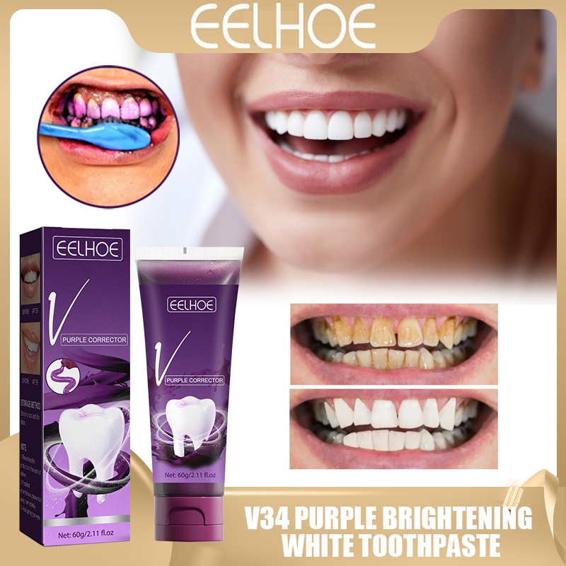 EELHOE Purple Toned Teeth Whitening Set main image 1