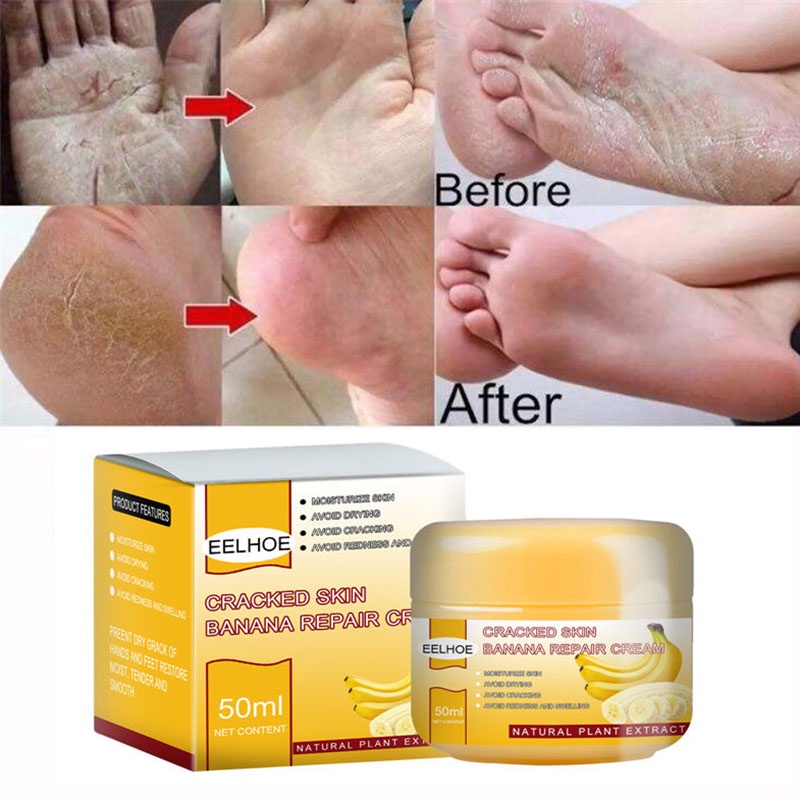 Banana Foot Cream 50g Moisturizing Cracked Heel Cream Anti-Fungal ...