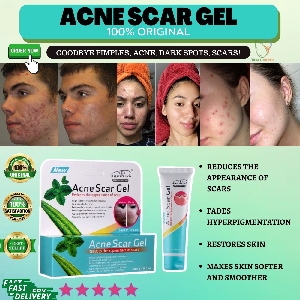 Original Acne Scar Gel Acne Scar Remover Pimple Mark Cream Dark Spot Remover Anti Scar Peklat 1493