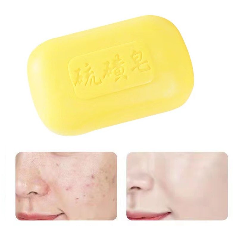 Handmade Sulfur Soap OilControl Acne Treatment Skin Whitening Soap