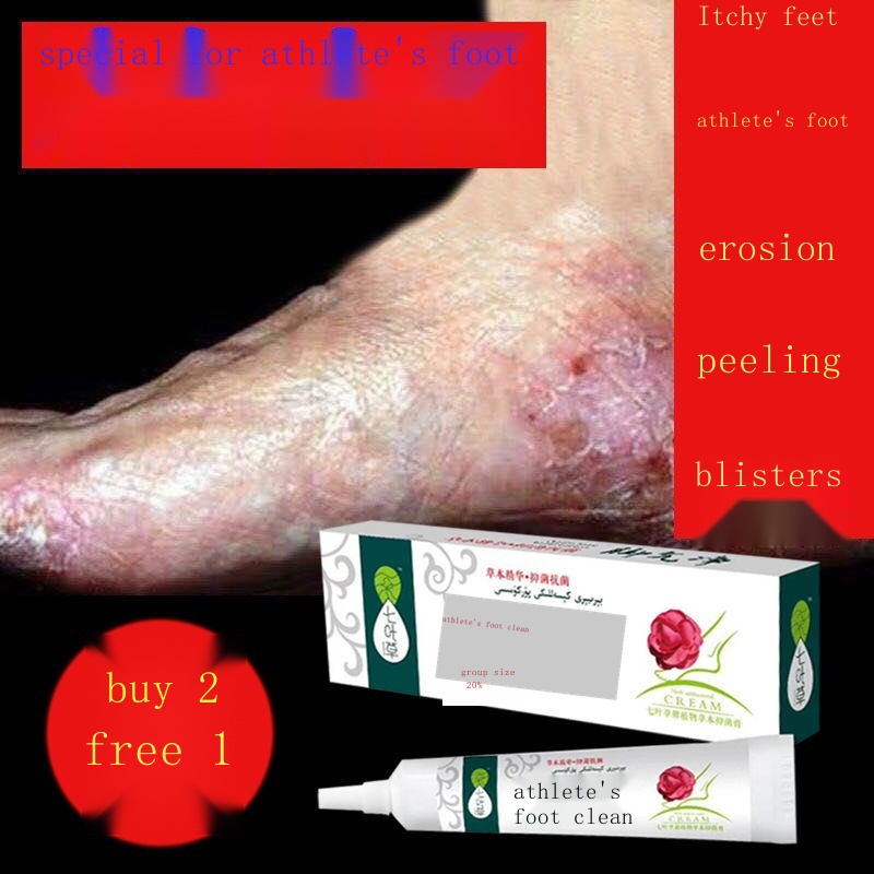 Athlete s foot king athlete s foot odor rotten feet anti-itch cream for ...