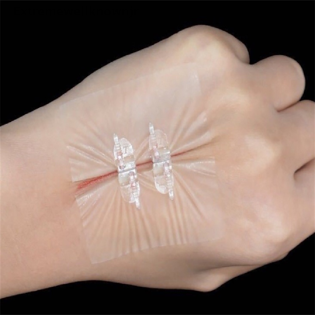 ERPH 2PC/box Bandage Band Aid Zip Stitches Zip Tie Wound Closure