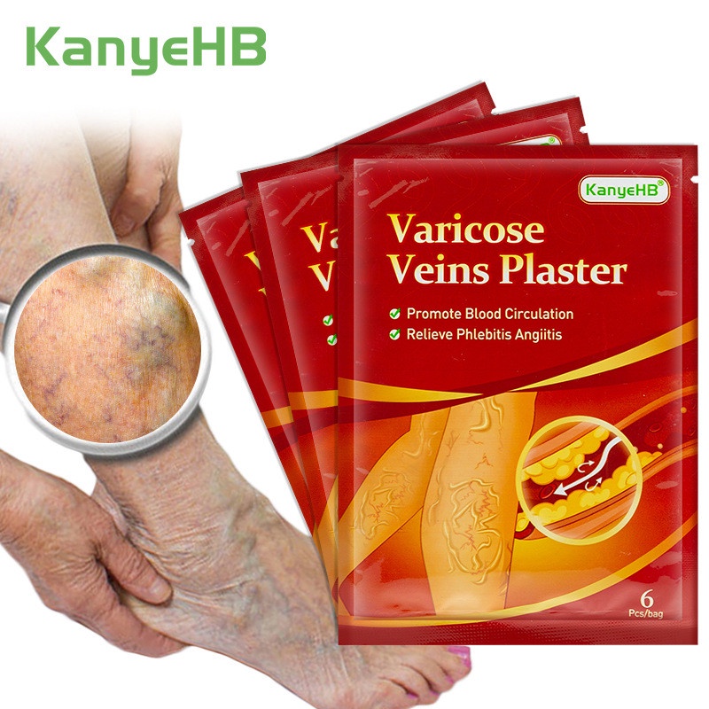 30pcs Varicose Veins Patches Leg Vasculitis Phlebitis Spider Anti ...