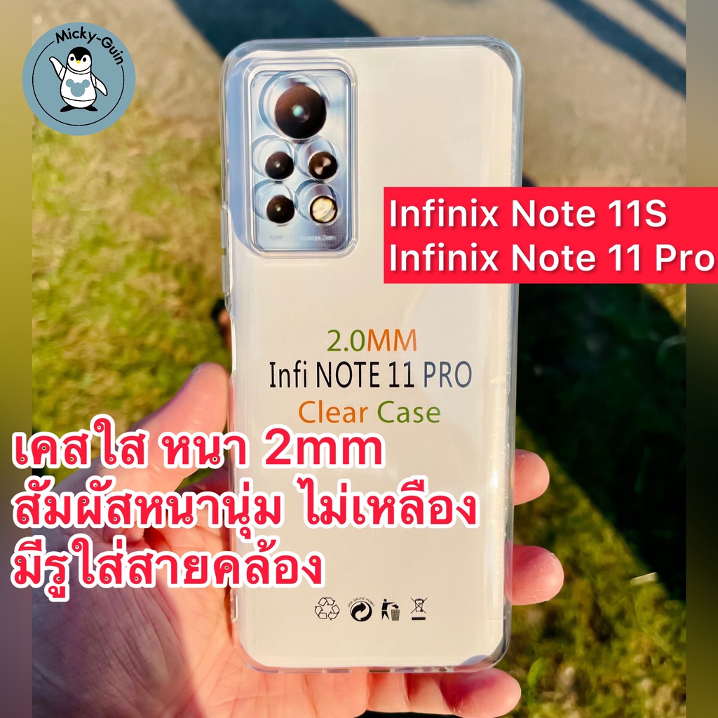 Infinix Note 11S/11 Pro Case Clear Camera Protection Shockproof ...