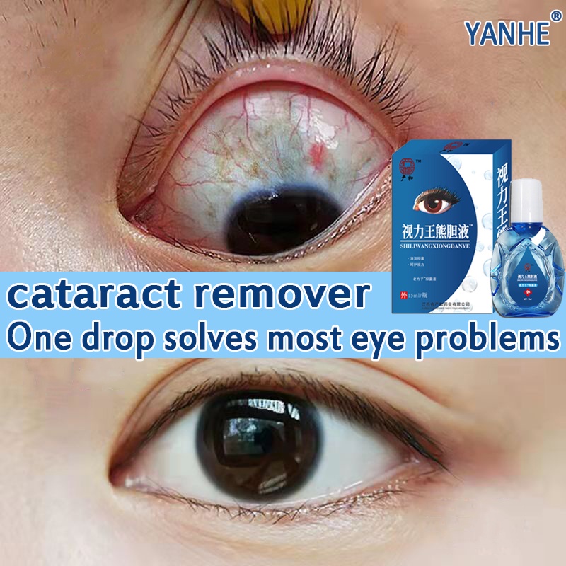 YH eye drops for cataract original patak sa mata cataract remover