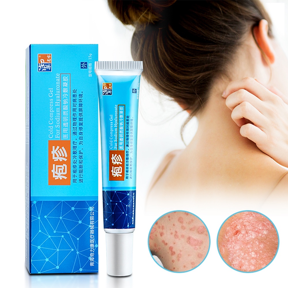 15g Herpes Zoster Treatment Cream Genital Herpes Relief Ointment