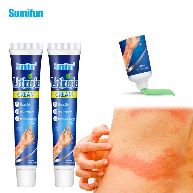 Urticaria Cream Herbal Antibacterial Psoriasis Dermatitis
