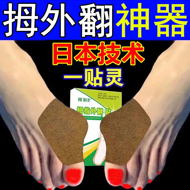 Hallux valgus artifact technology big foot bone corrector toe deformity