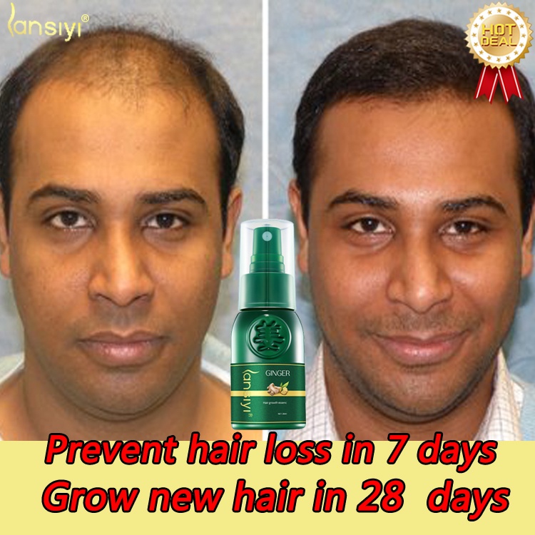 LANSIYI Hair Growth Spray 30ml Original ginger extract oil control and
