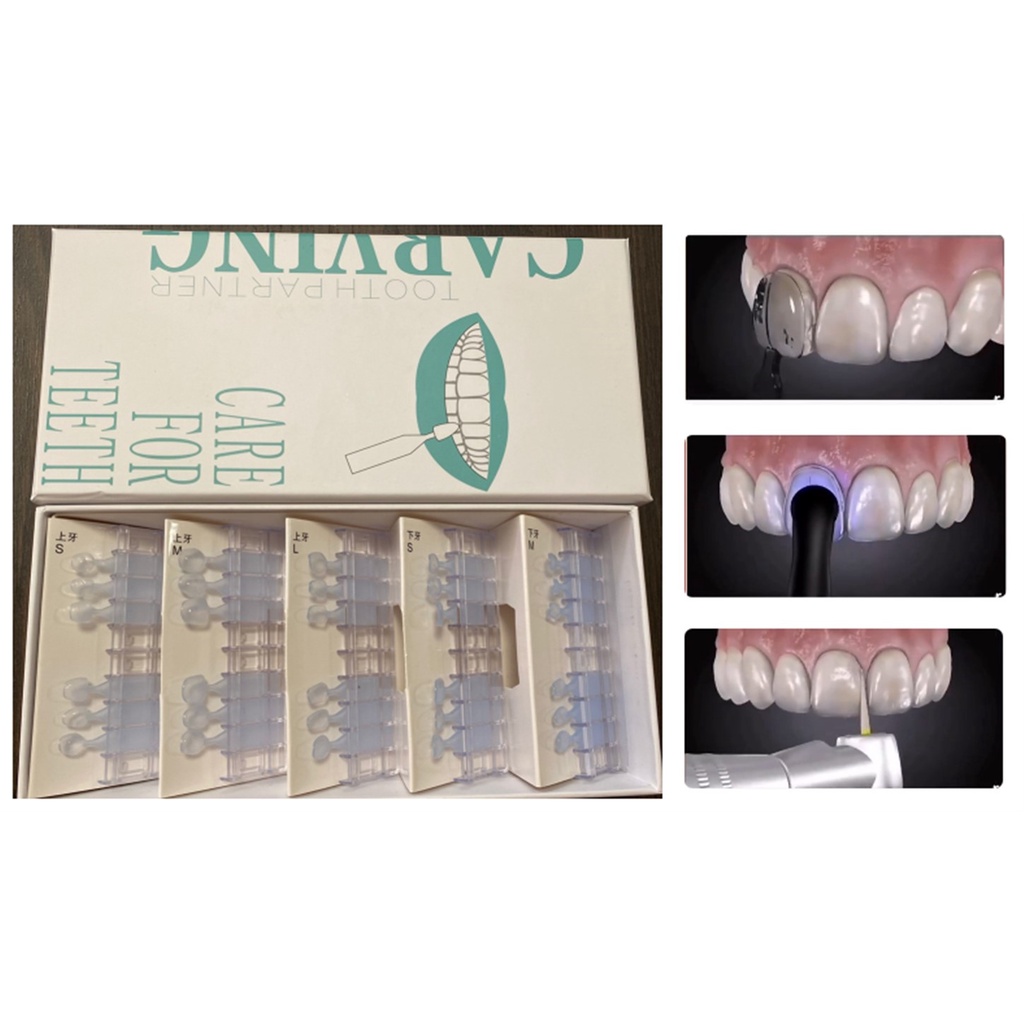 Dental Mould For Tooth Veneers Composite Resin Light Cure Filling