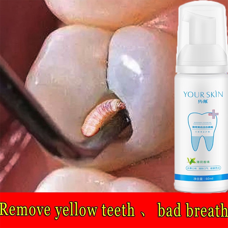 Teeth Whitening Teeth Cleaning Mousse Fresh Shining Tooth Cleaning