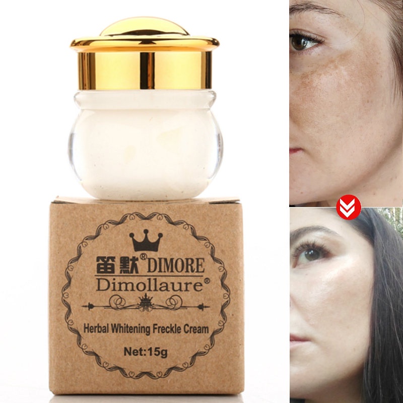 Dimollaure Face Whitening Cream Melasma Dark Spots Freckle Removal ...