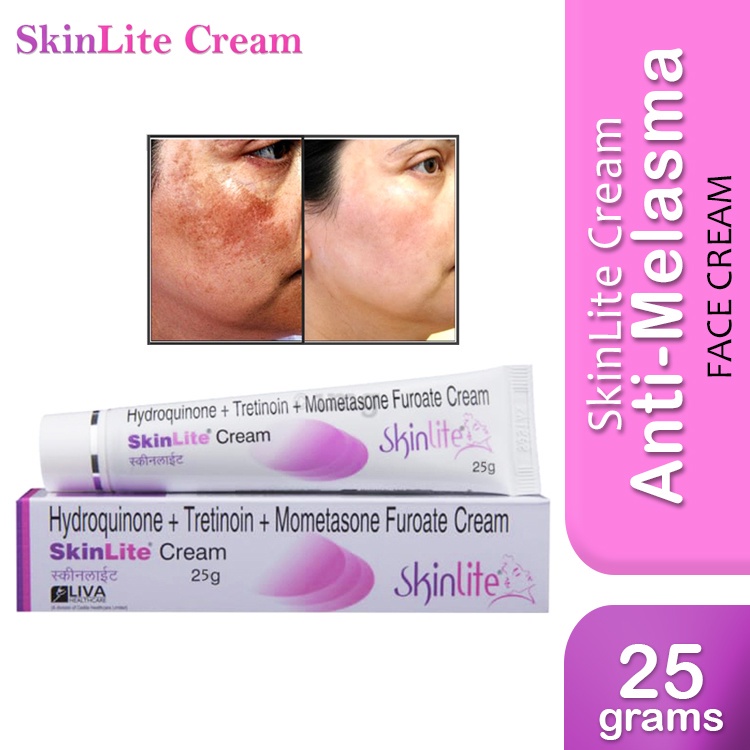 SKinlite Fade Skin Tone Cream Anti Melasma Face 25g Shopee Philippines